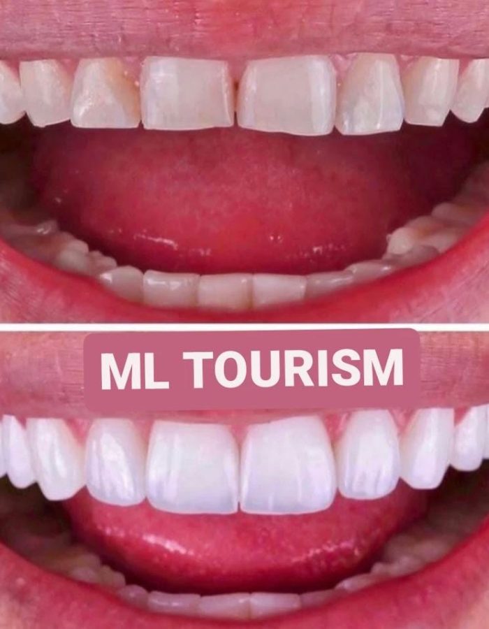 Ml tourism (10)