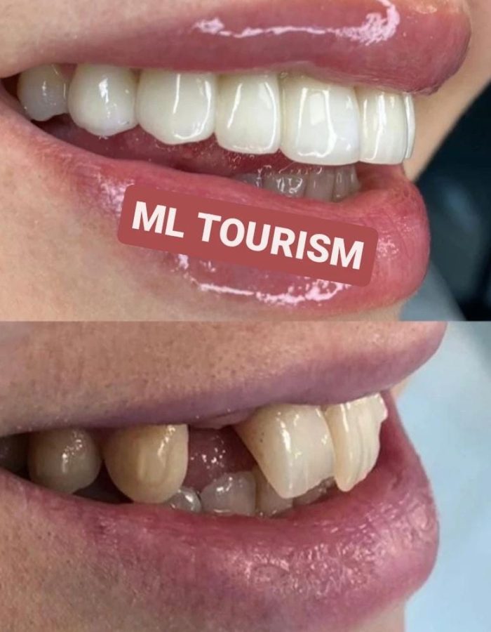 Ml tourism (11)