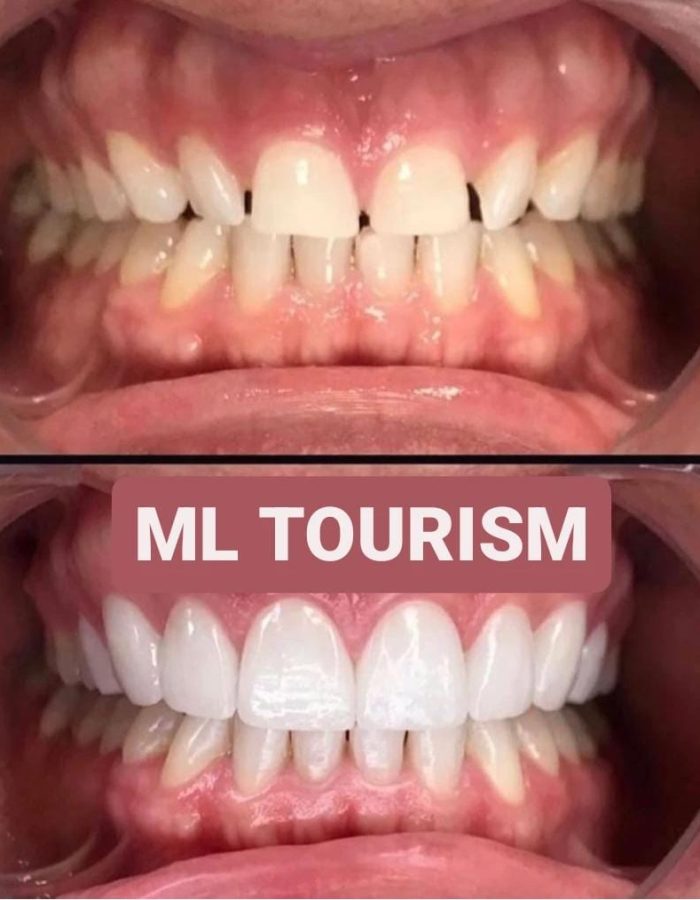 Ml tourism (12)