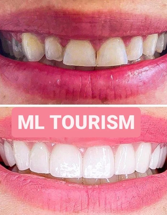 Ml tourism (15)