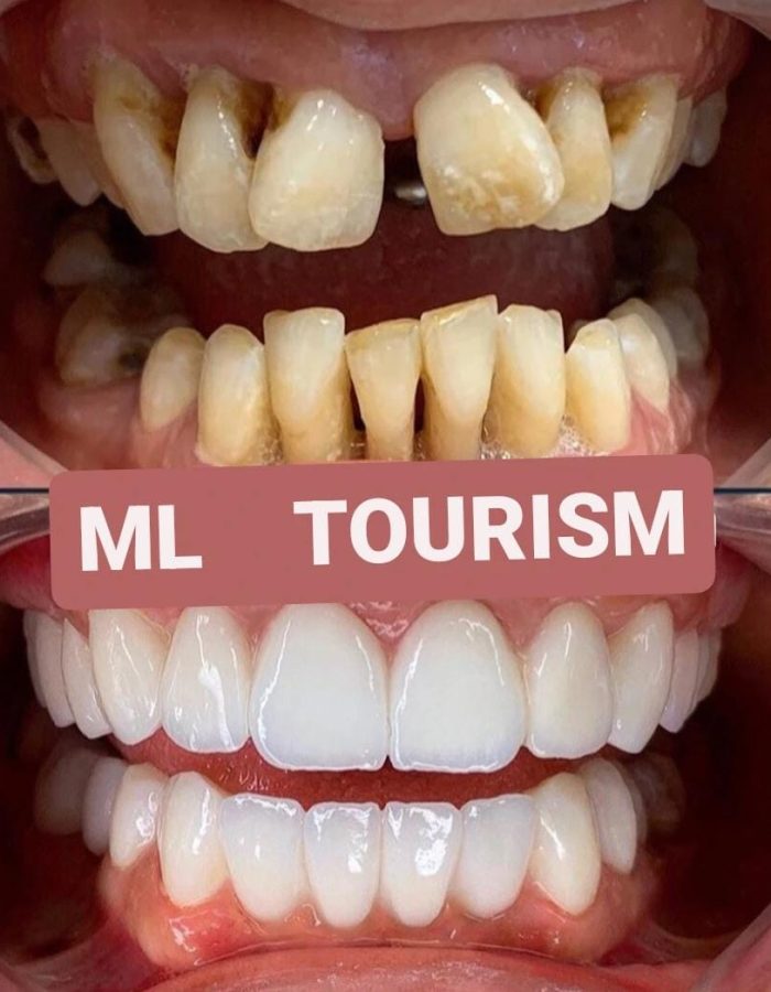 Ml tourism (4)