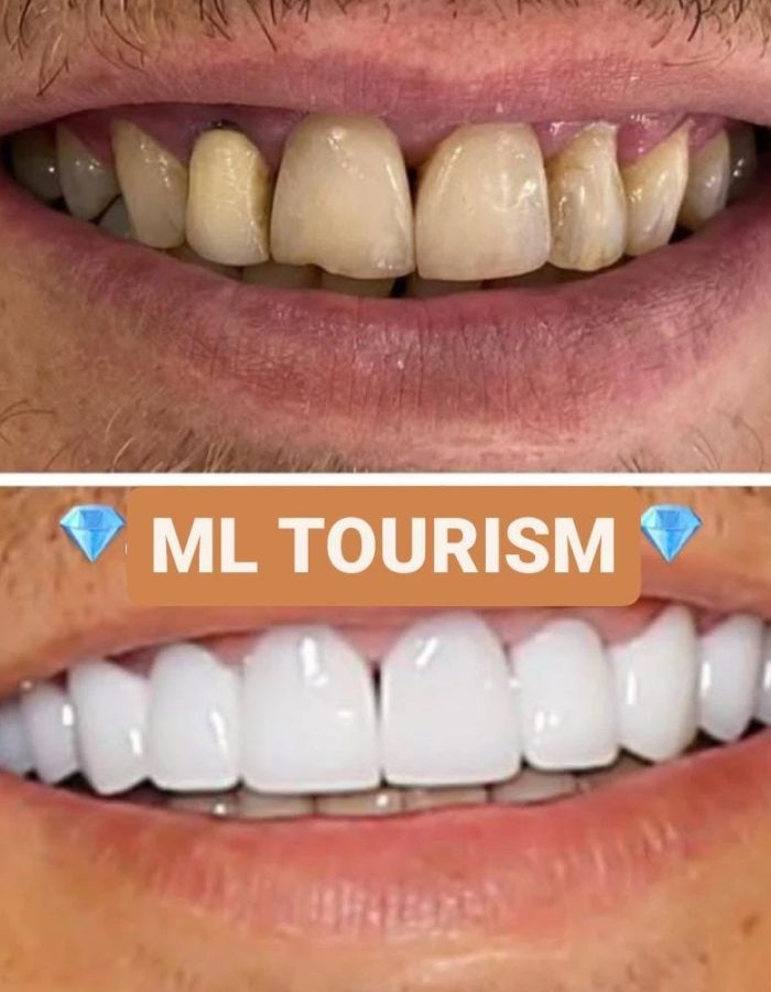 Ml tourism (7)